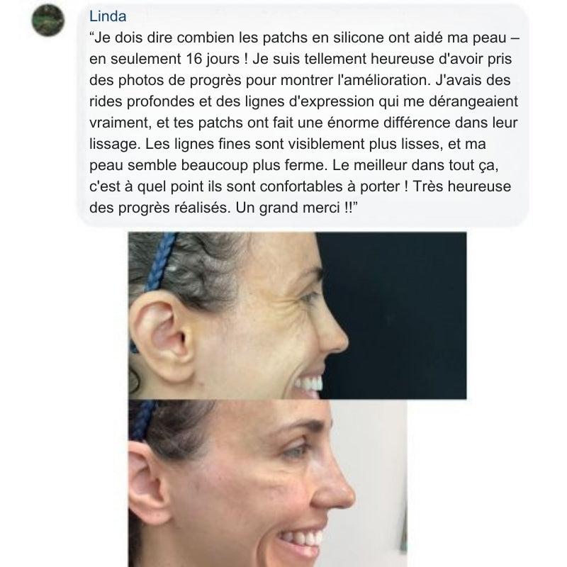 Cicatry - Bandes cicatrisantes